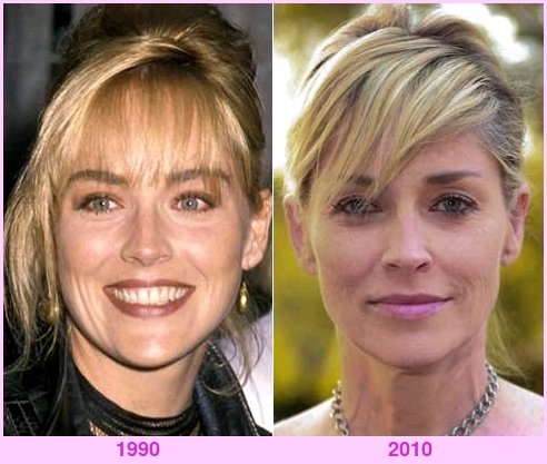 Sharon Stone - before and after
